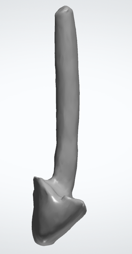 CÙI GIẢ SỨ ZIRCONIA